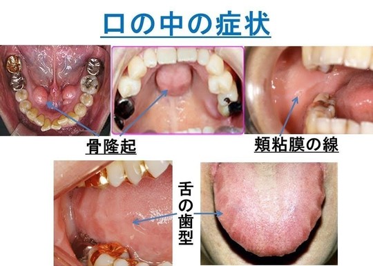TCHについて - 佐藤歯科医院