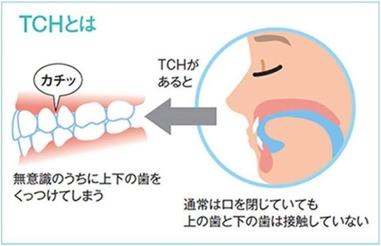 TCHについて - 佐藤歯科医院